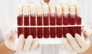 Анализ крови при онкологии