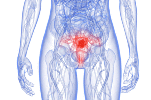 Рак матки лечение и симптомы