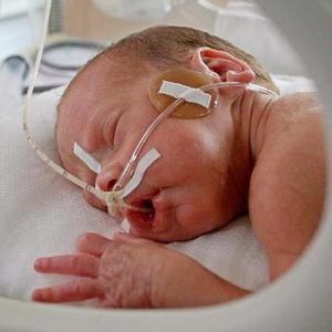 Церебральная ишемия 1 степени у новорожденного