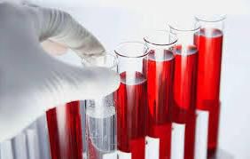 Мочевая кислота в крови повышена: причины, симптомы и лечение