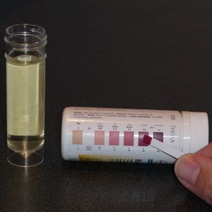 Тест полоски для определения ацетона в моче