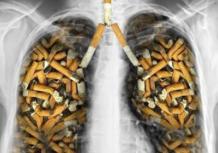 Сколько нужно курить, чтобы получить рак легких?