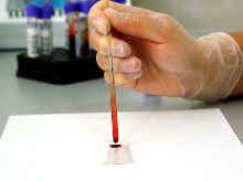 Как поднять тромбоциты в крови после химиотерапии