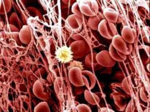 Как поднять тромбоциты в крови после химиотерапии