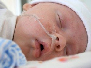Церебральная ишемия 1 степени у новорожденного
