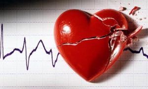 Осложнения инфаркта миокарда