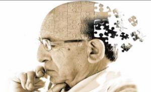 Лечение Альцгеймера в молодом возрасте