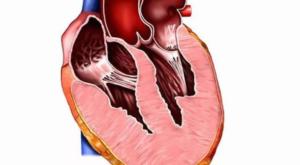 Симптомы и лечение кардиомиопатии