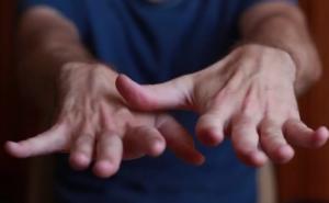 Тремор рук - симптомы и причины