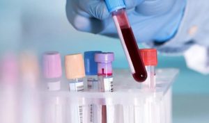 Анализ крови на энцефалит - результаты