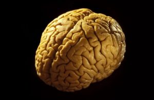 Кора головного мозга: симптомы