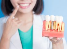 Имплантация зубов – много видов, удивительные возможности
