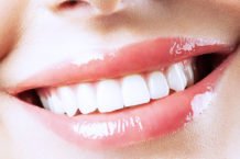 Отбеливание зубов и гигиена полости рта