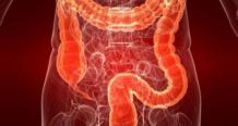 Опухоль толстого кишечника: симптомы на ранней стадии
