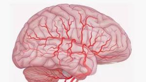 Поражение головного мозга и его причины