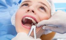 Факторы, влияющие на стоимость удаления зуба